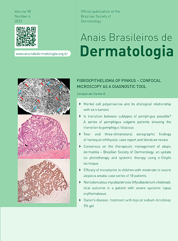 Go to journal home page - Anais Brasileiros de Dermatologia